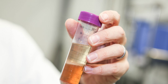 Ein Probengefäß mit einer Flüssigkeit in hellgelber Farbe im Labor.