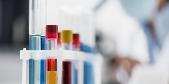 A set of test tubes filled with various red and blue liquids.