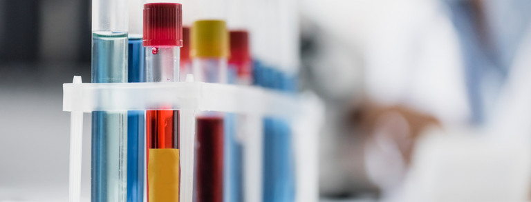 Set of test tubes A set of test tubes filled with various red and blue liquids.